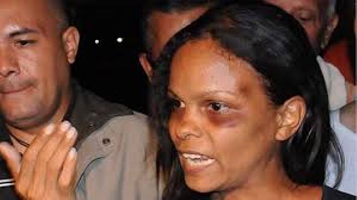 Marvinia Jiménez was brutally beaten by the Venezuela National Guard during a demonstration.