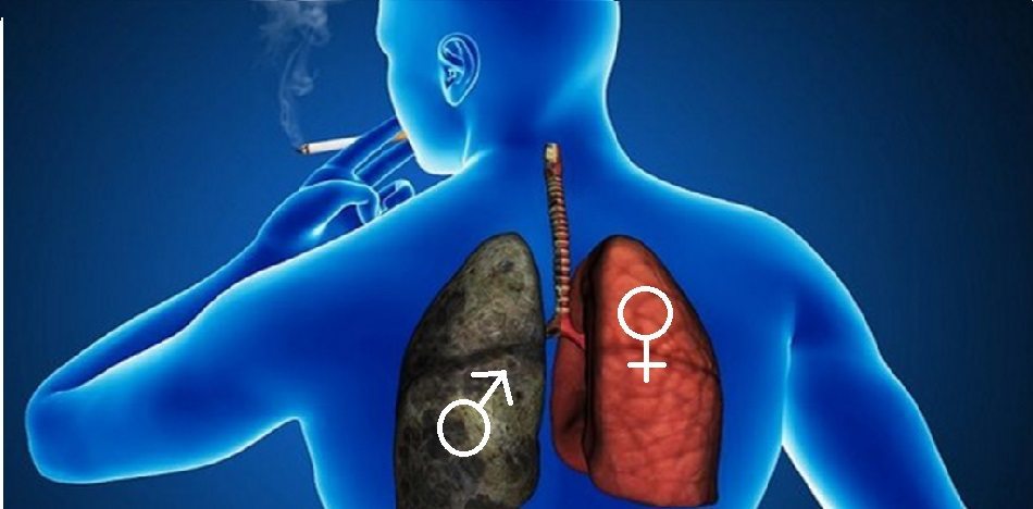 Pese a que 75% de los casos de cáncer pulmonar son varones, la noticia resalta el 25%.(FotoMontaje)