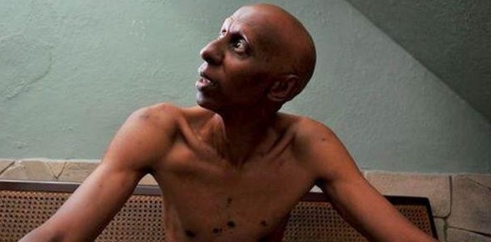 Guillermo Fariñas - huelga de hambre