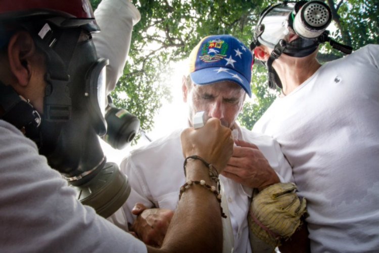 El gobernador Henrique Capriles afectado por los efectos de las bombas lacrimógenas. (Leo Álvarez)