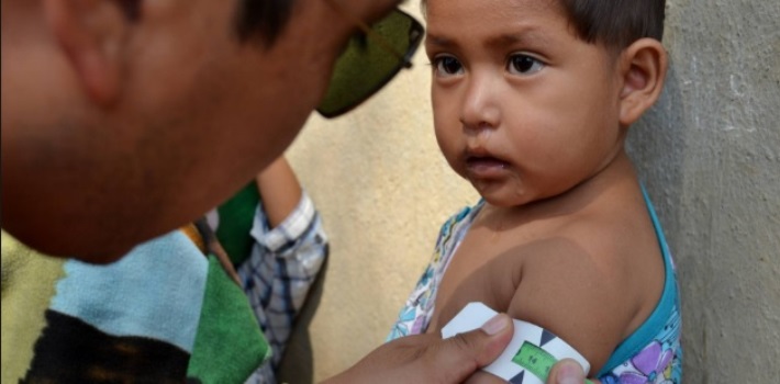 Starving Children Puts Strain on Venezuela’s Hospitals Malnutrición-Venezuela